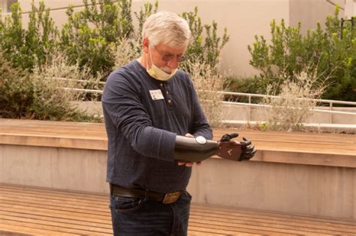 Donated Prosthetic Limbs Get a Second Life